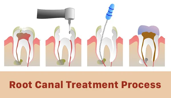 Dr. Neha Dental Clinic