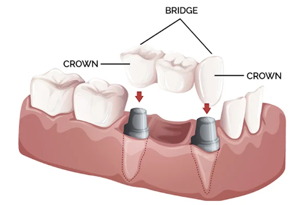 Dr. Neha Dental Clinic