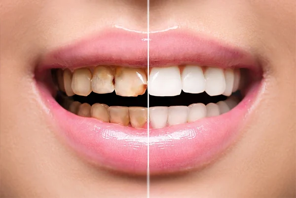 Dr. Neha Dental Clinic