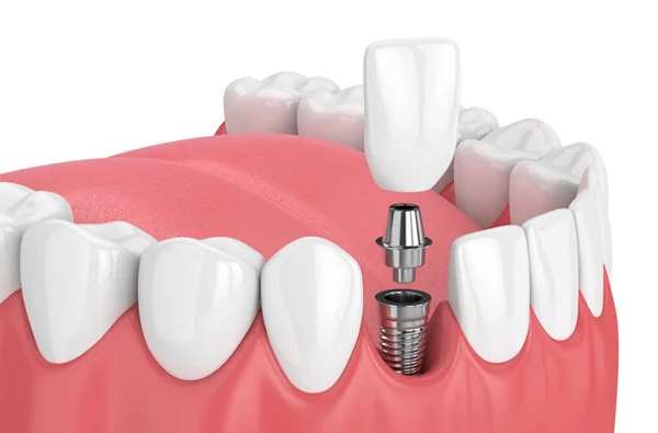Dr. Neha Dental Clinic