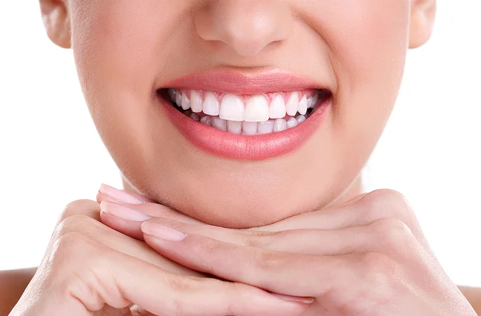 Smile Designing