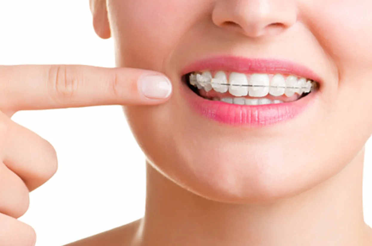 Orthodontics
